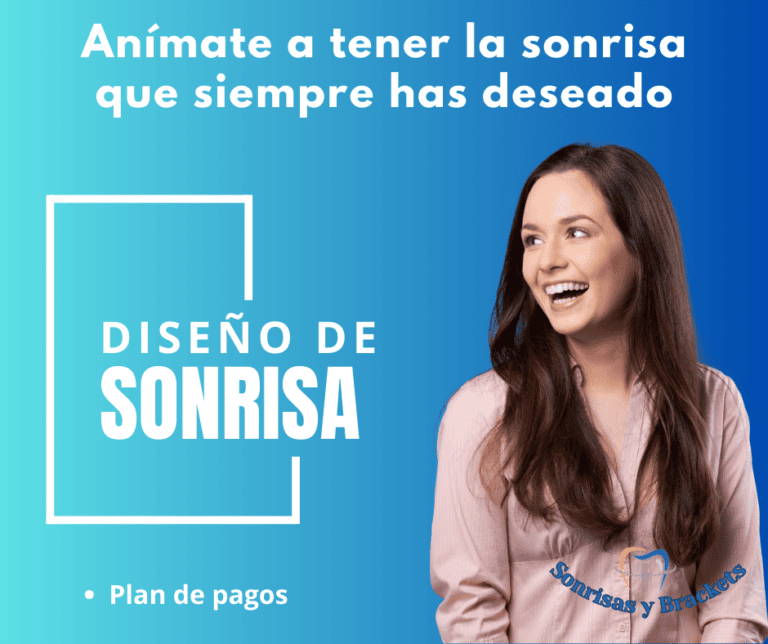 Diseño de Sonrisa